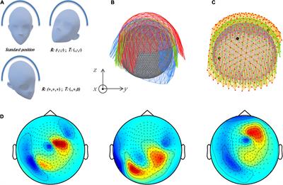 Source localization using virtual magnetoencephalography <mark class="highlighted">helmet</mark>s: A simulation study toward a prior-based tailored scheme